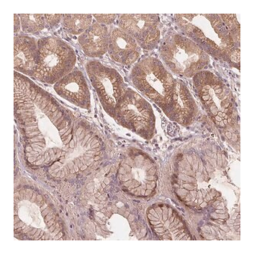 Merck Anti-AKT1S1 antibody produced in rabbit