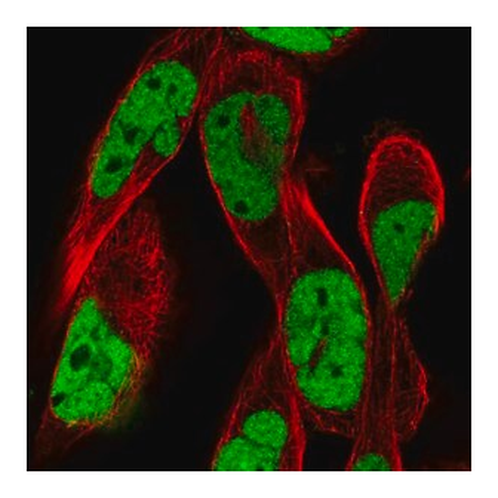 Merck Anti-RSF1 antibody produced in rabbit