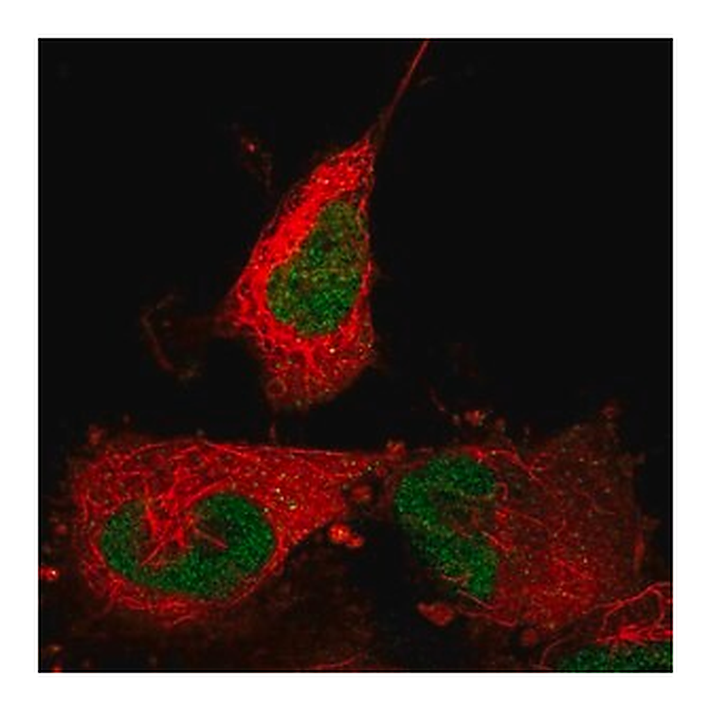 Merck Anti-ABTB2 antibody produced in rabbit