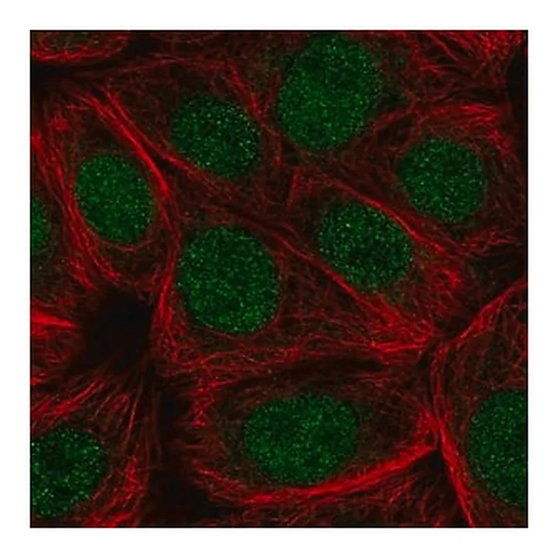 Merck Anti-CDC73 antibody produced in rabbit