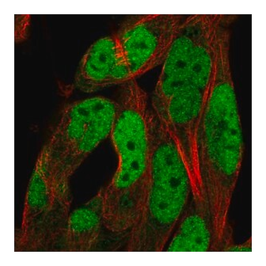 Merck Anti-ADAMTS5 antibody produced in rabbit