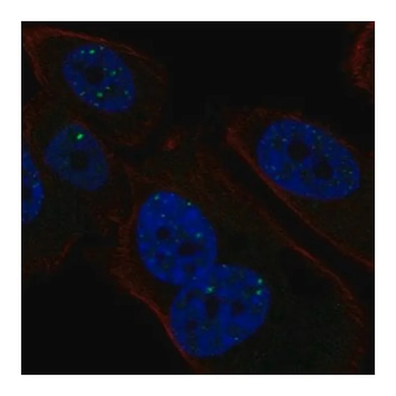 Merck Anti-PMS1 antibody produced in rabbit