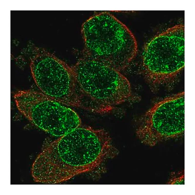 Merck Anti-TRPM2 antibody produced in rabbit