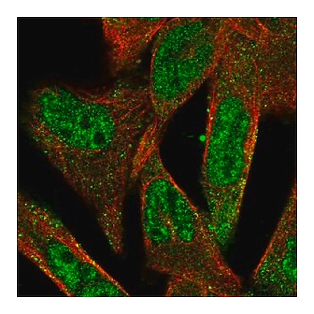 Merck Anti-ADAMTS5 antibody produced in rabbit