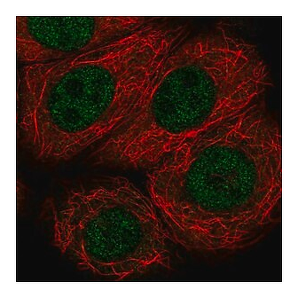 Merck Anti-VHL antibody produced in rabbit