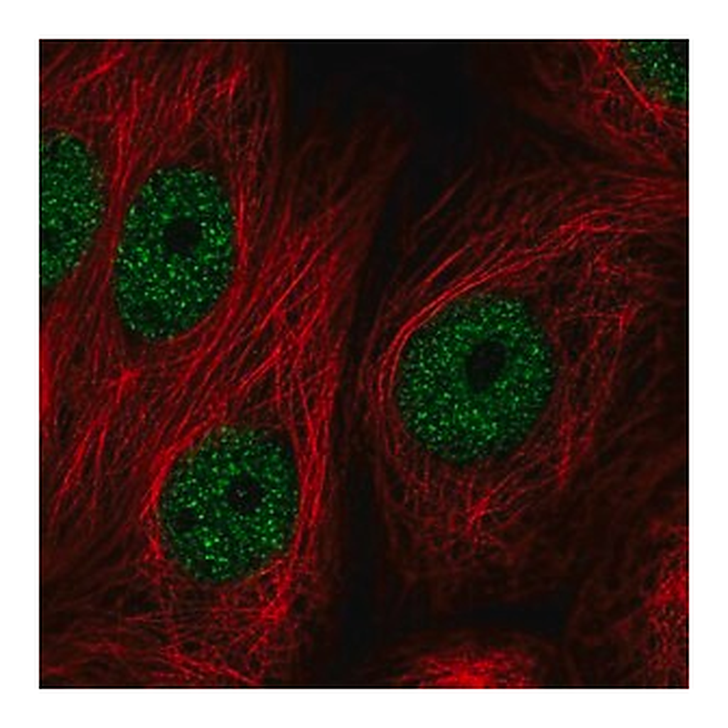 Merck Anti-ZBTB21 antibody produced in rabbit