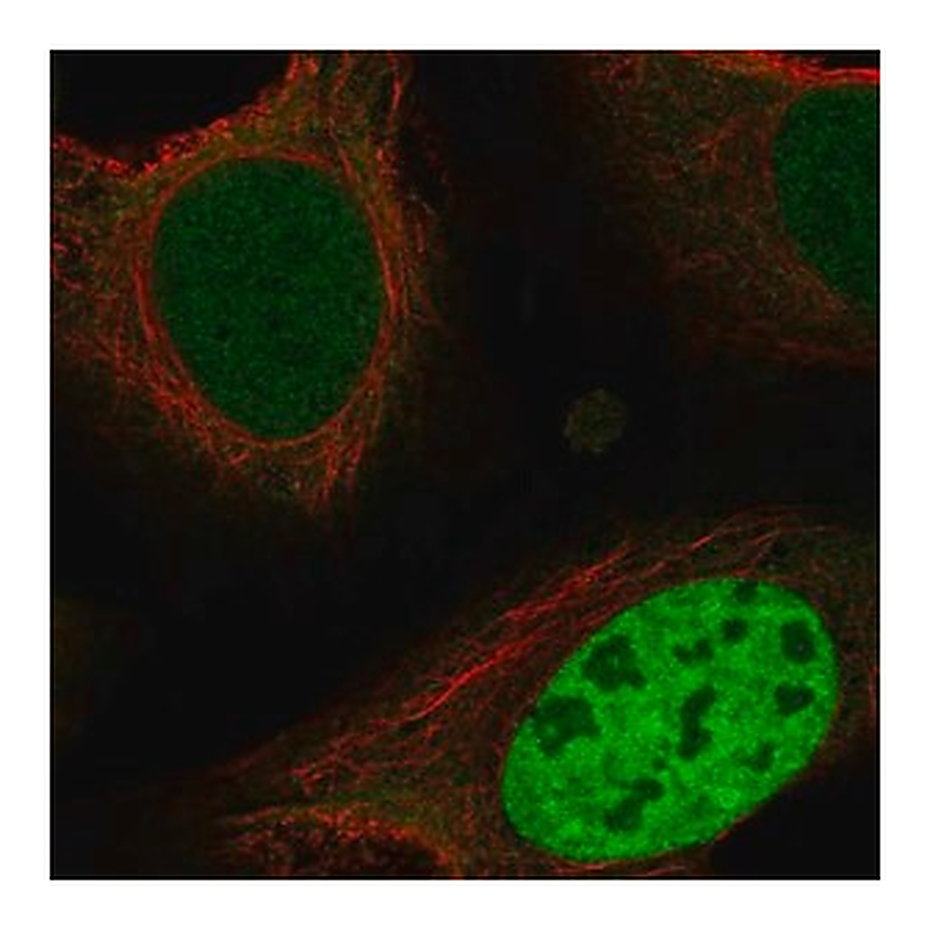 Merck Anti-ING4 antibody produced in rabbit
