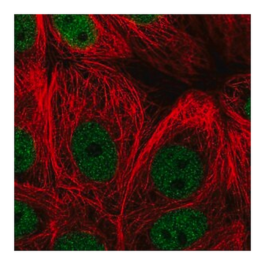 Merck Anti-ZBTB21 antibody produced in rabbit