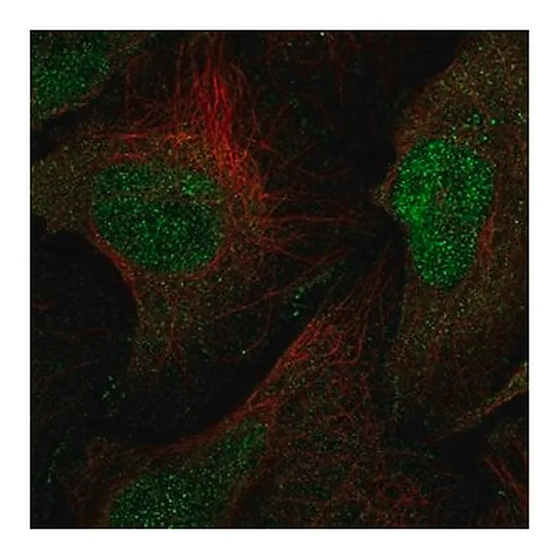 Merck Anti-MAGI1 antibody produced in rabbit