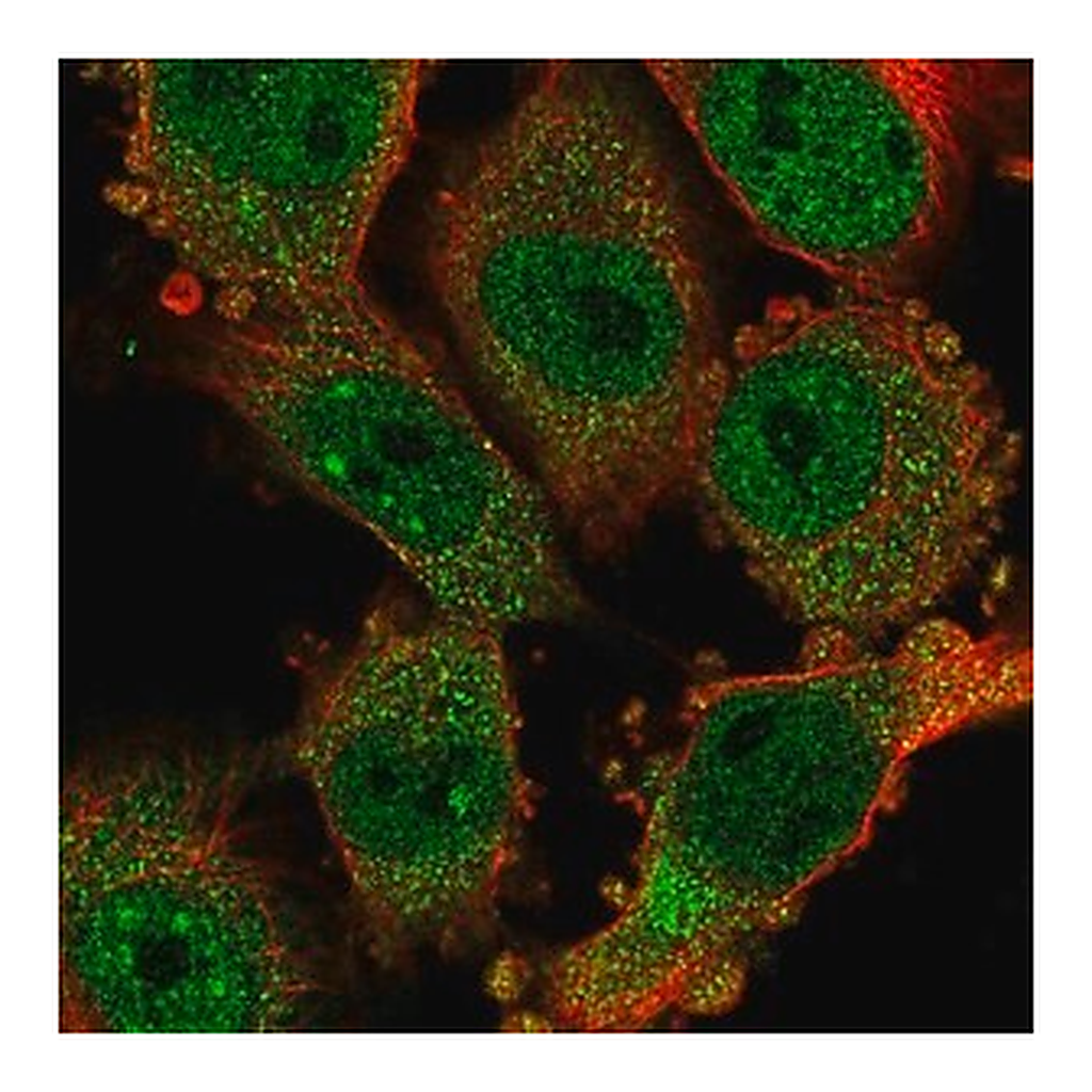 Merck Anti-CCDC159 antibody produced in rabbit