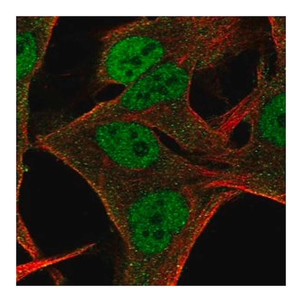 Merck Anti-NMRK2 antibody produced in rabbit