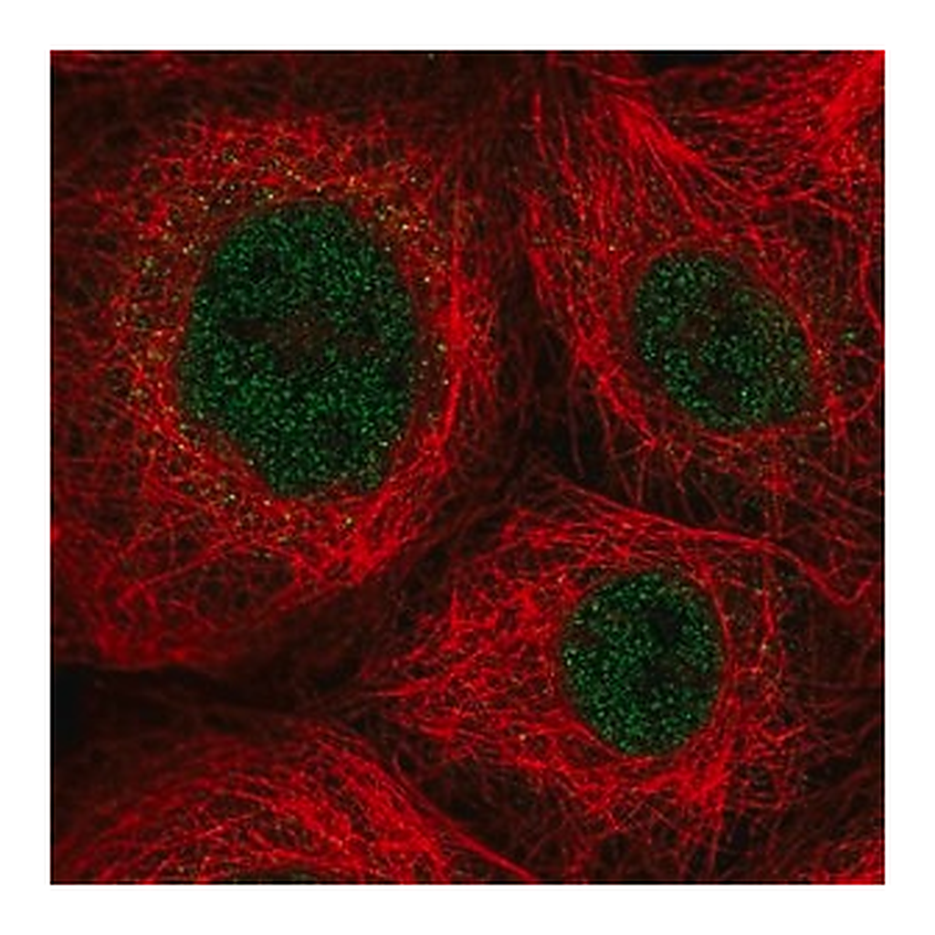 Merck Anti-ZNF22 antibody produced in rabbit