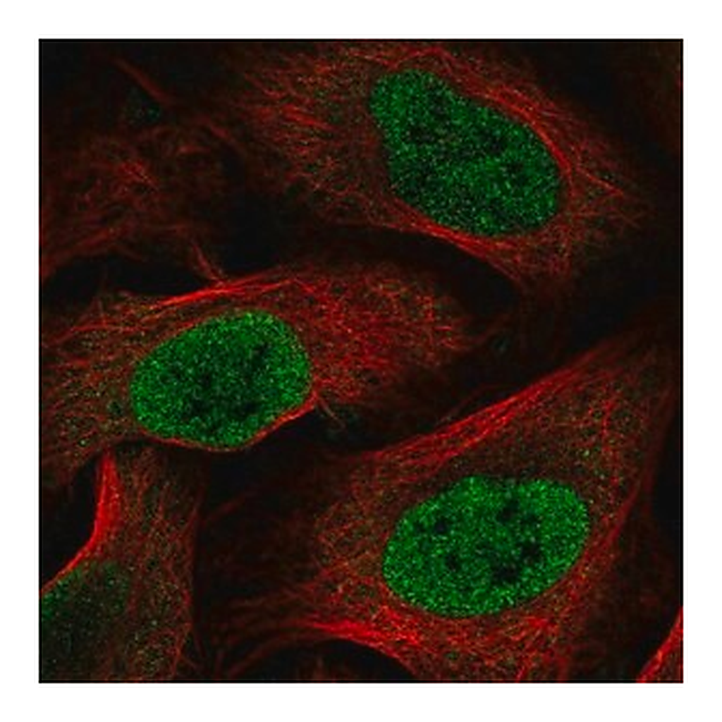 Merck Anti-HOXC6 antibody produced in rabbit