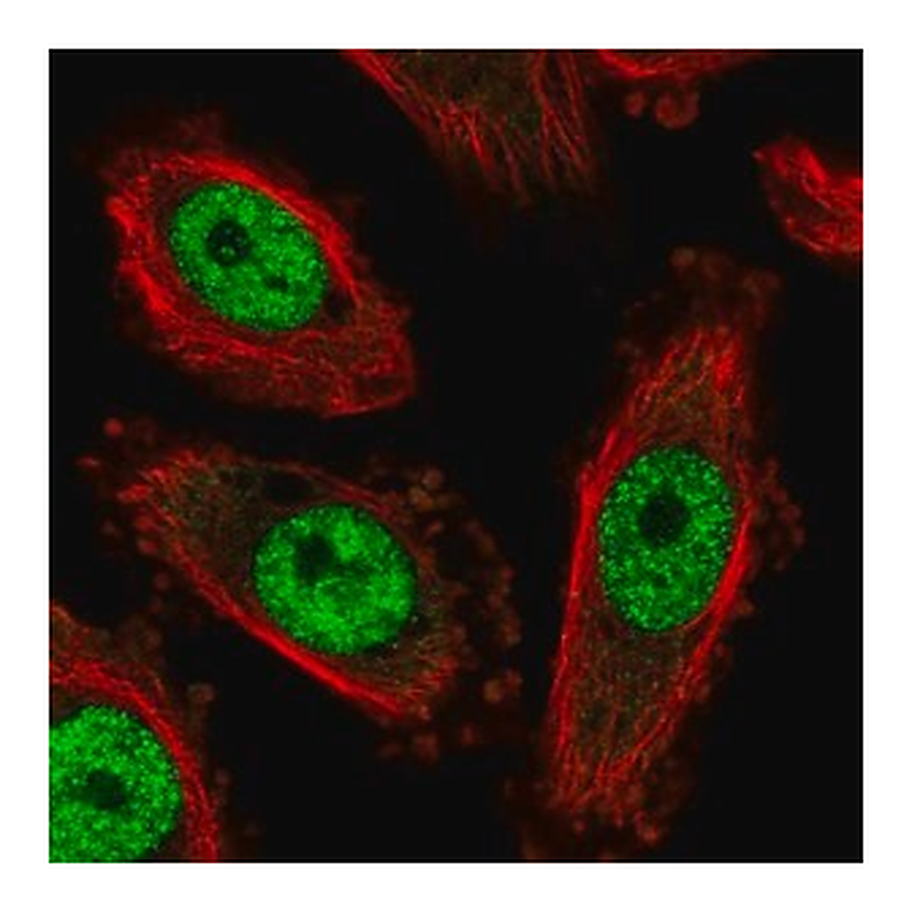Merck Anti-NFYC antibody produced in rabbit