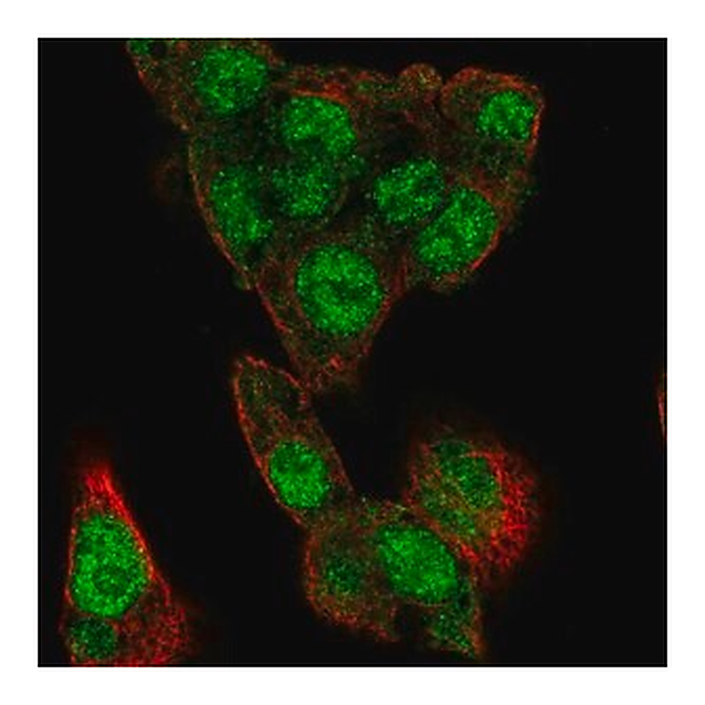 Merck Anti-MLXIPL antibody produced in rabbit