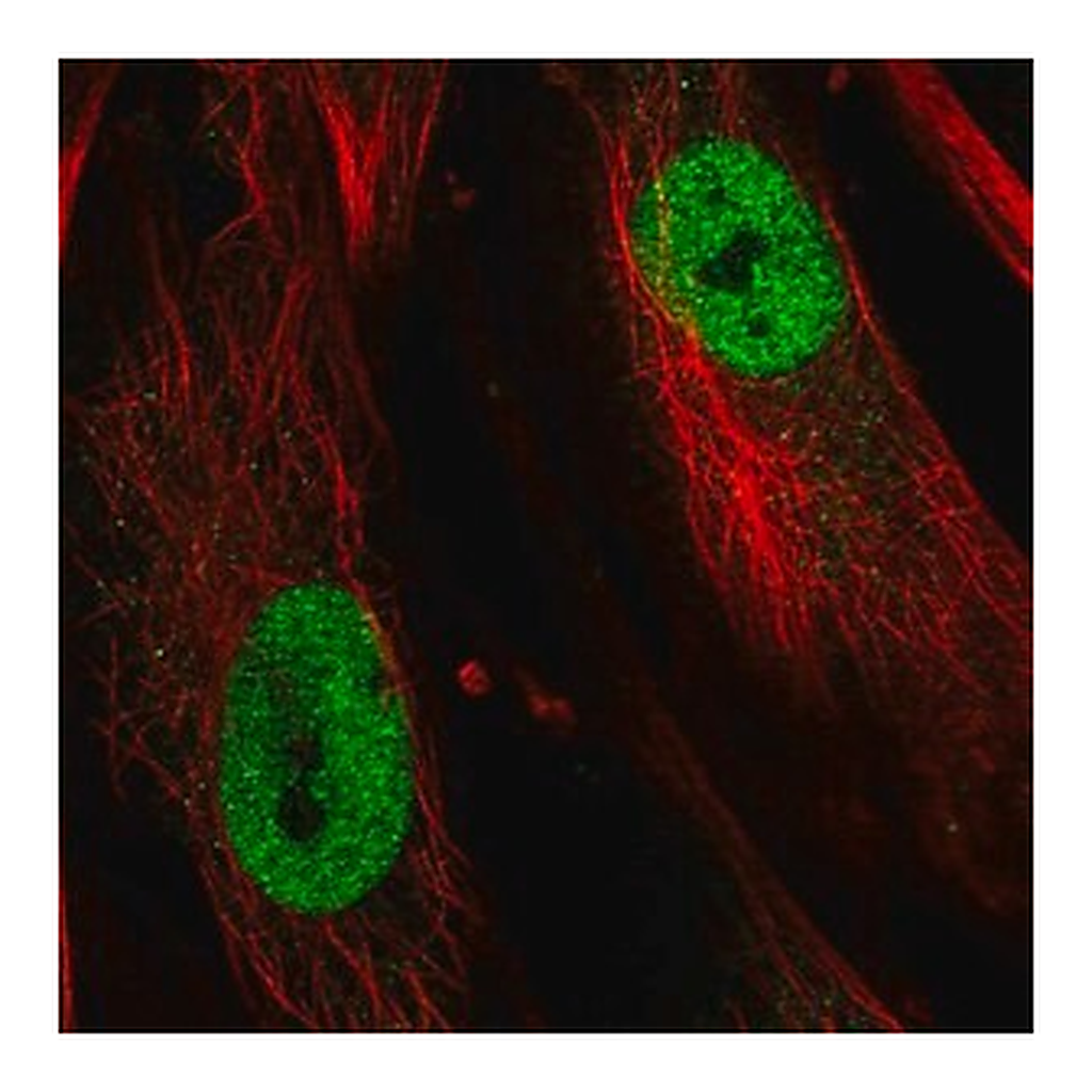 Merck Anti-TBX5 antibody produced in rabbit