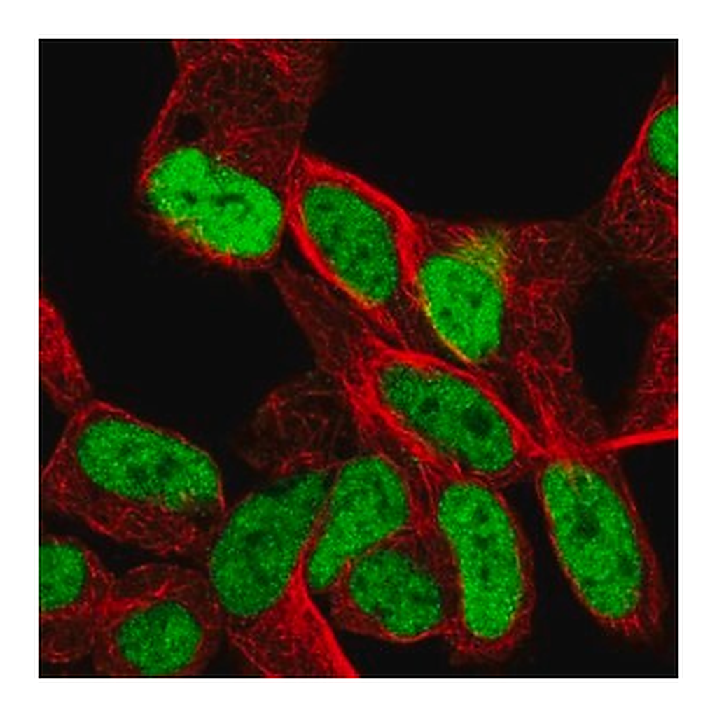 Merck Anti-SMARCA1 antibody produced in rabbit