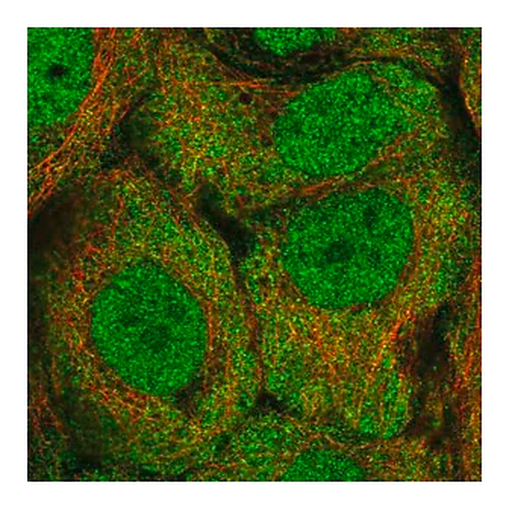 Merck Anti-ALDH1A3 antibody produced in rabbit