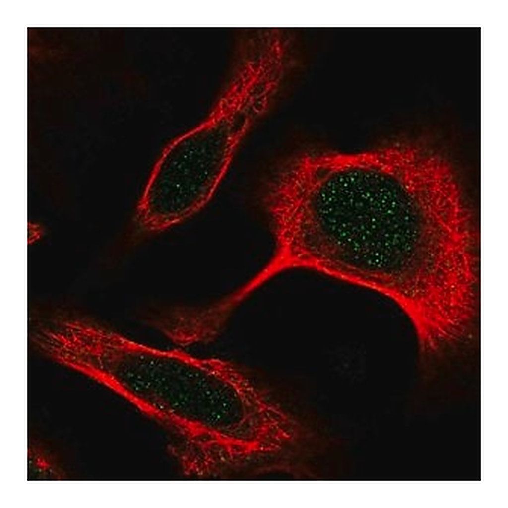 Merck Anti-DAPK3 antibody produced in rabbit