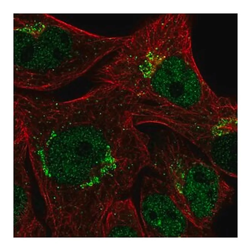 Merck Anti-CYP2U1 antibody produced in rabbit