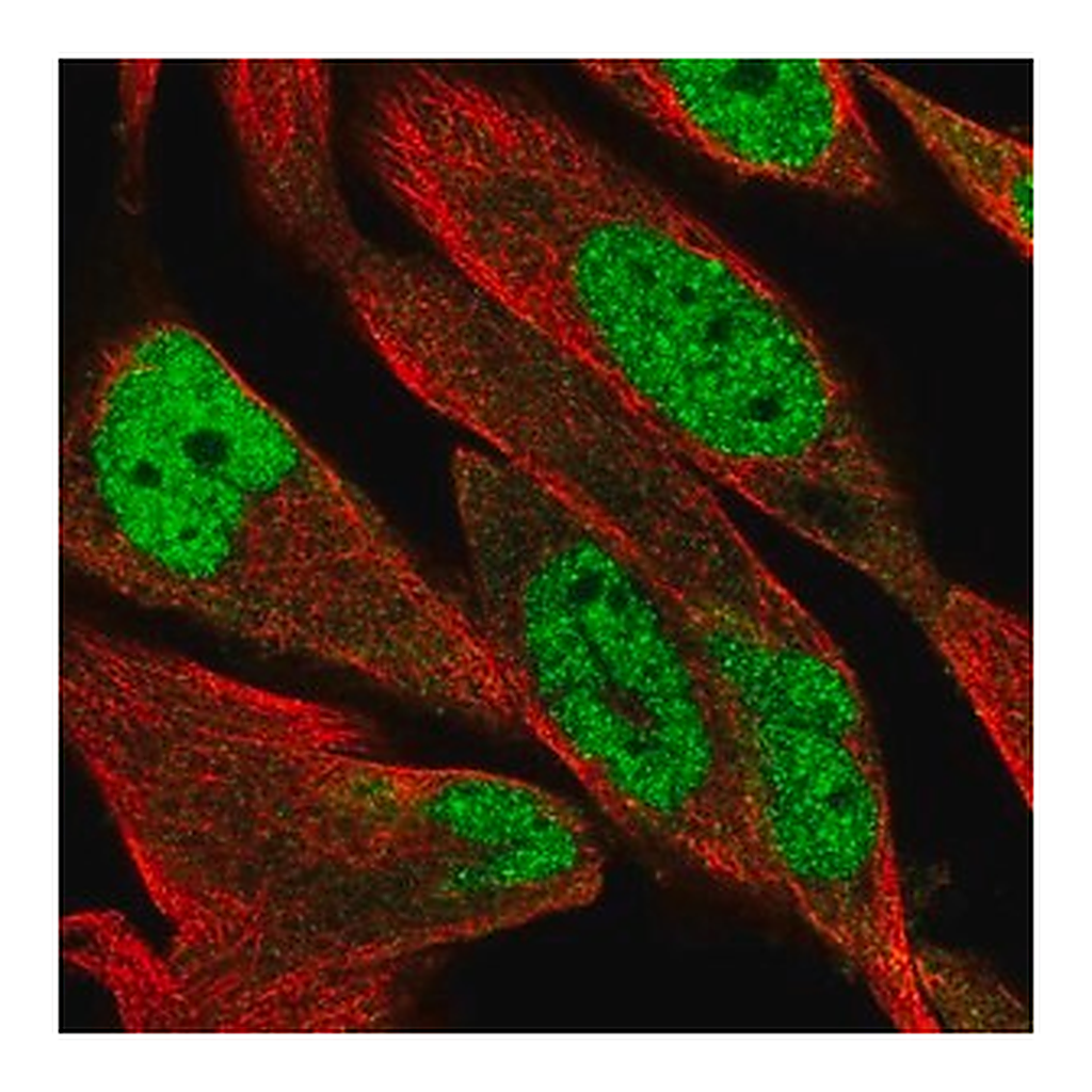 Merck Anti-DCLRE1B antibody produced in rabbit