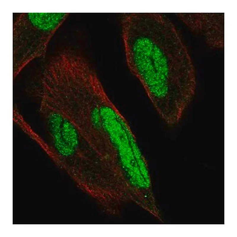 Merck Anti-PKNOX1 antibody produced in rabbit