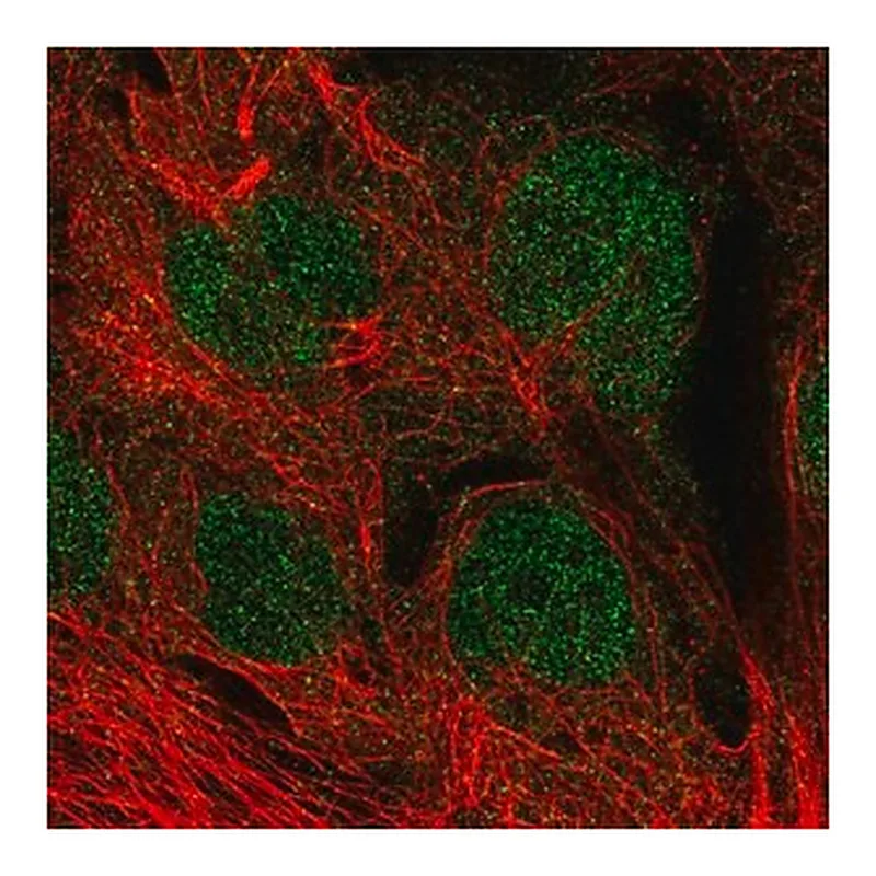 Merck Anti-MGMT antibody produced in rabbit
