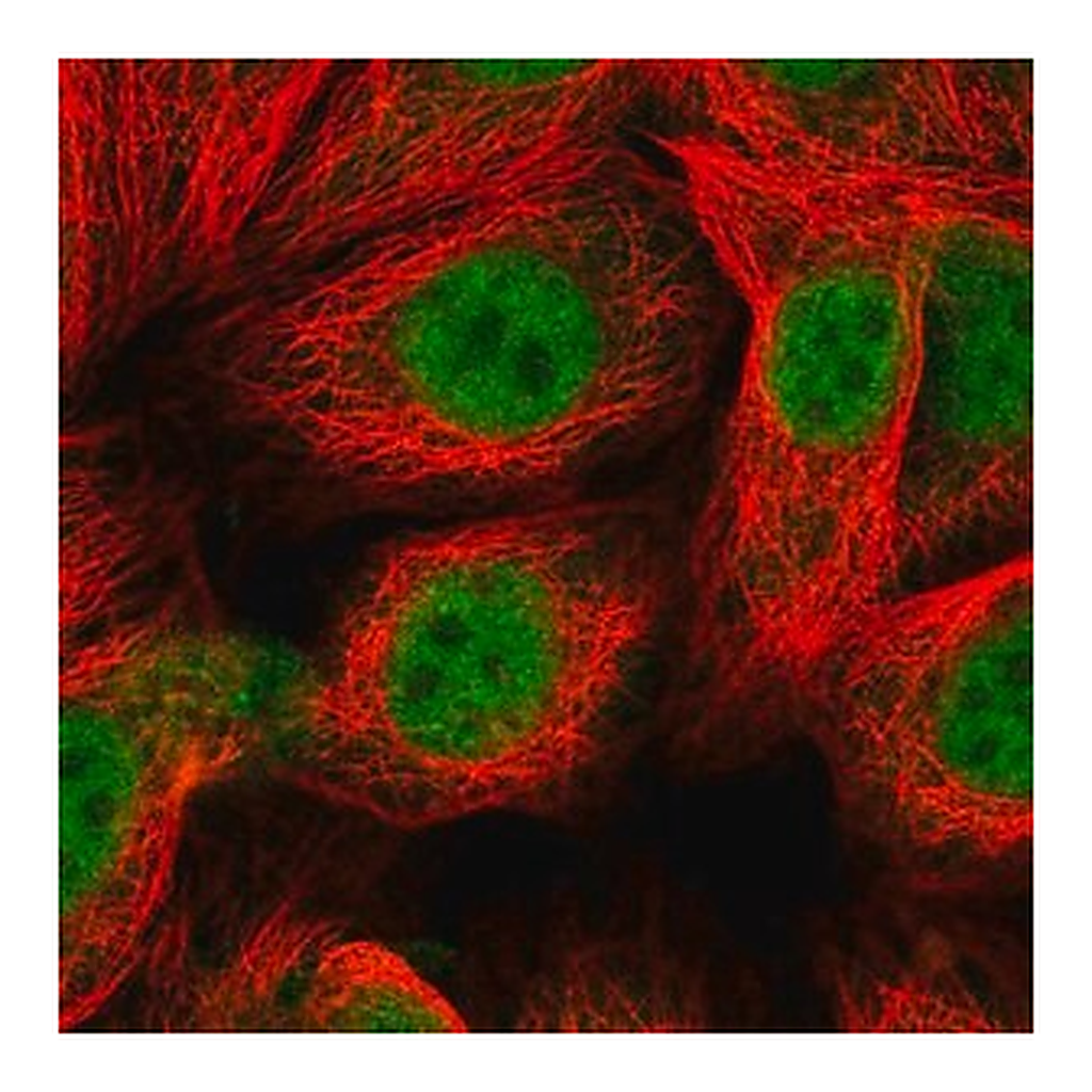 Merck Anti-MGMT antibody produced in rabbit