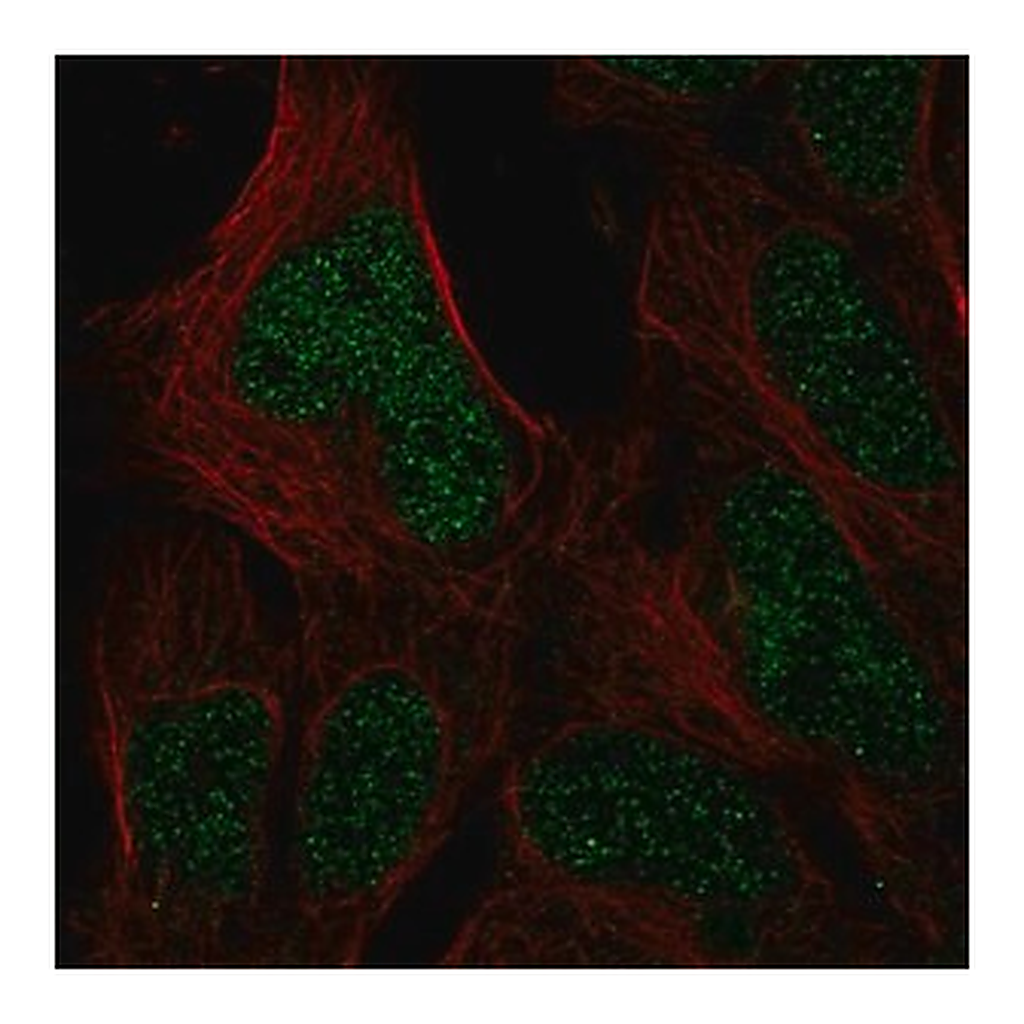 Merck Anti-HUS1B antibody produced in rabbit