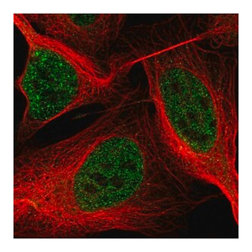 Merck Anti-ASXL2 antibody produced in rabbit