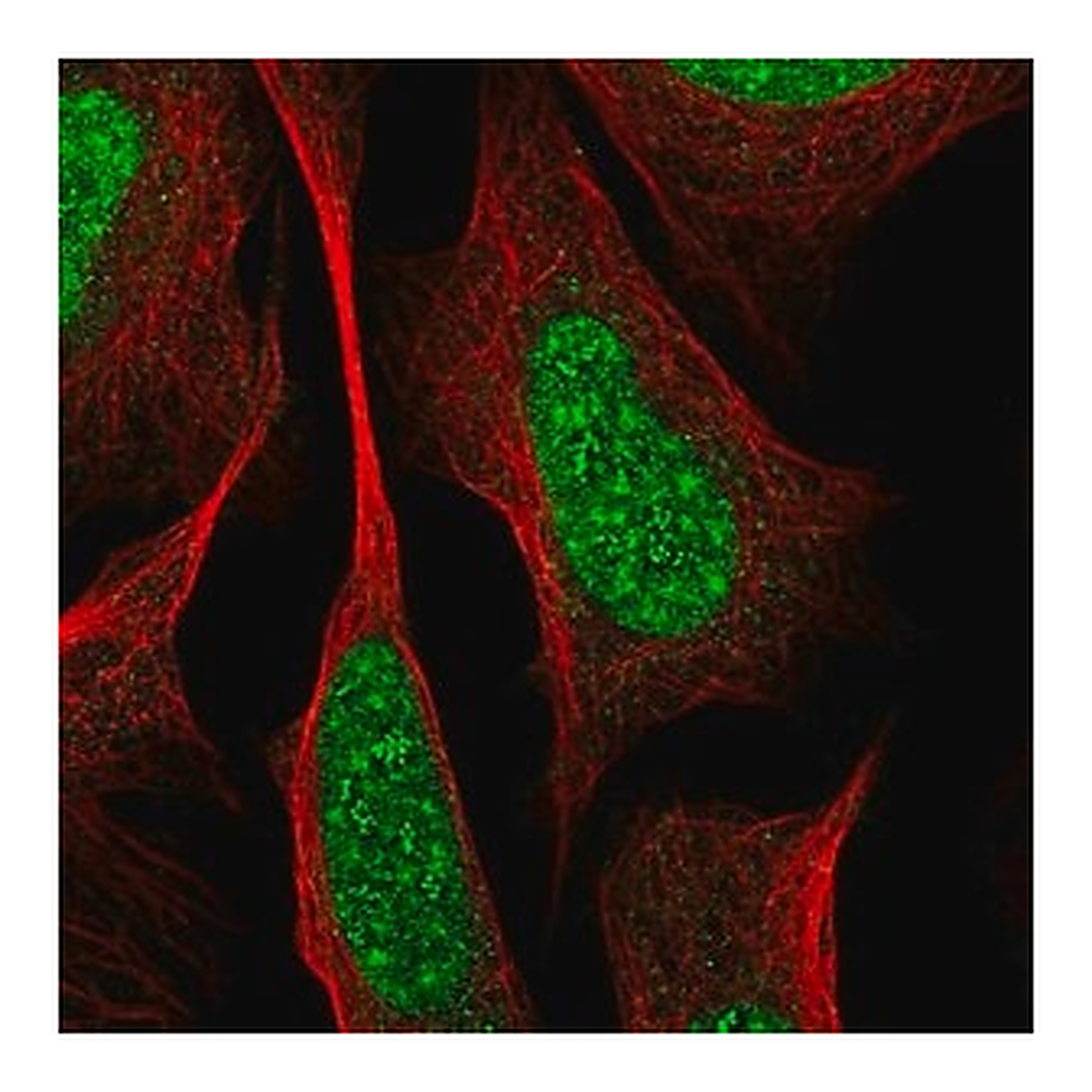 Merck Anti-RREB1 antibody produced in rabbit