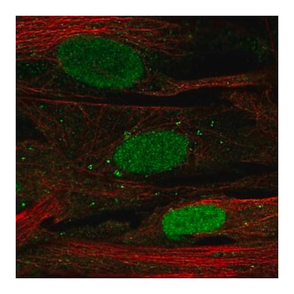 Merck Anti-SHOX antibody produced in rabbit