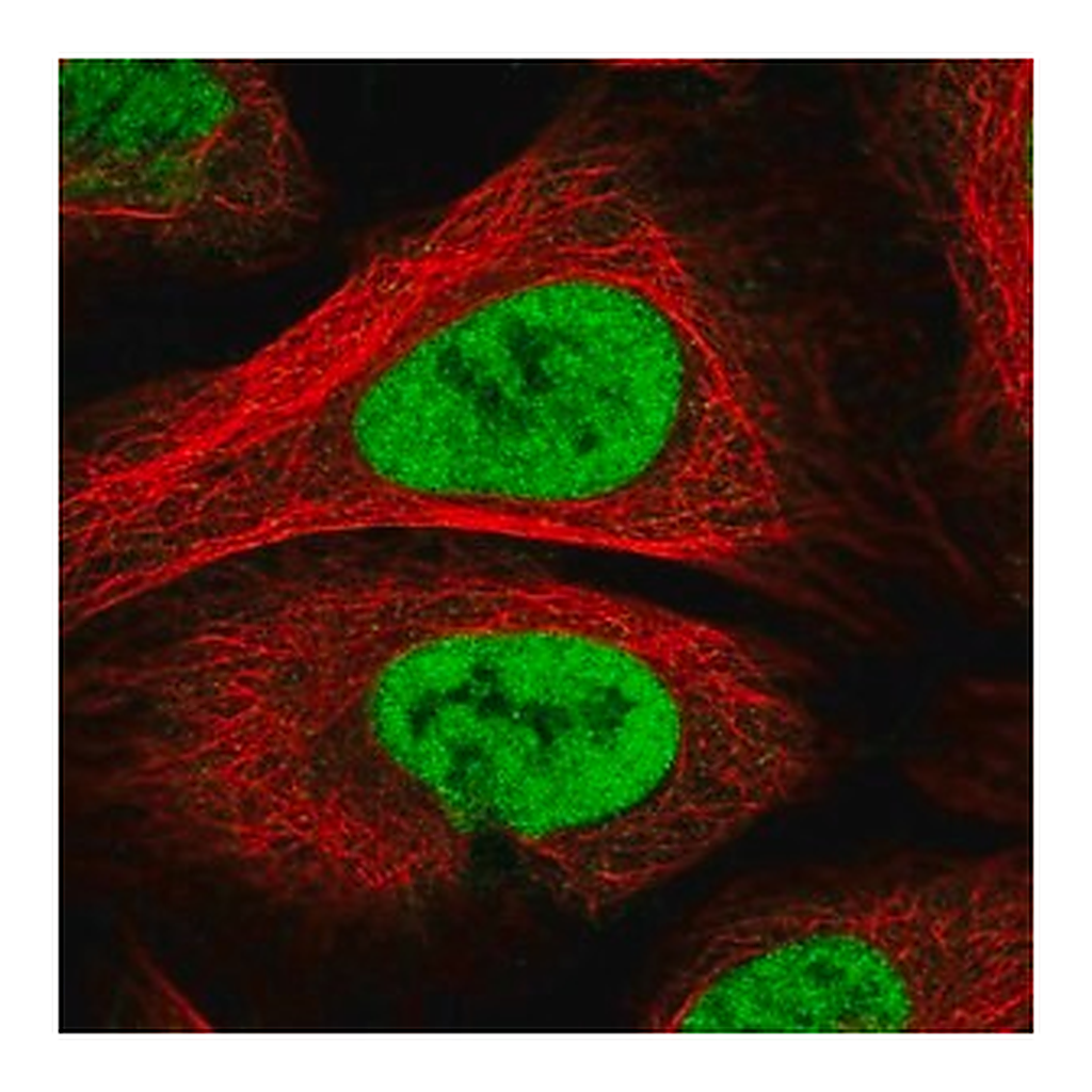 Merck Anti-PAPOLG antibody produced in rabbit