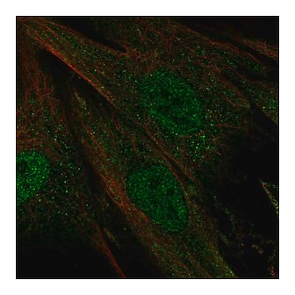 Merck Anti-CERKL antibody produced in rabbit