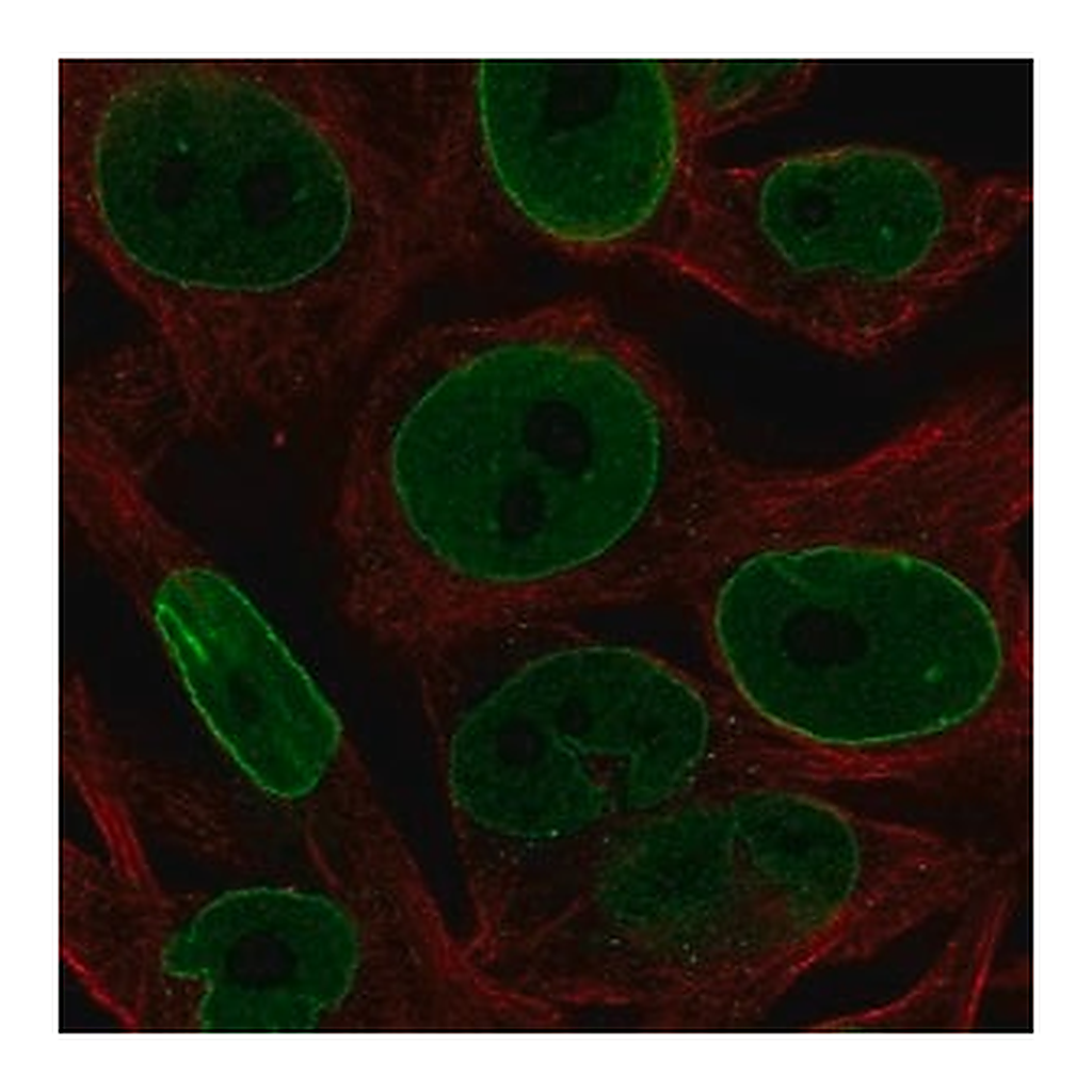 Merck Anti-BCL2 antibody produced in rabbit