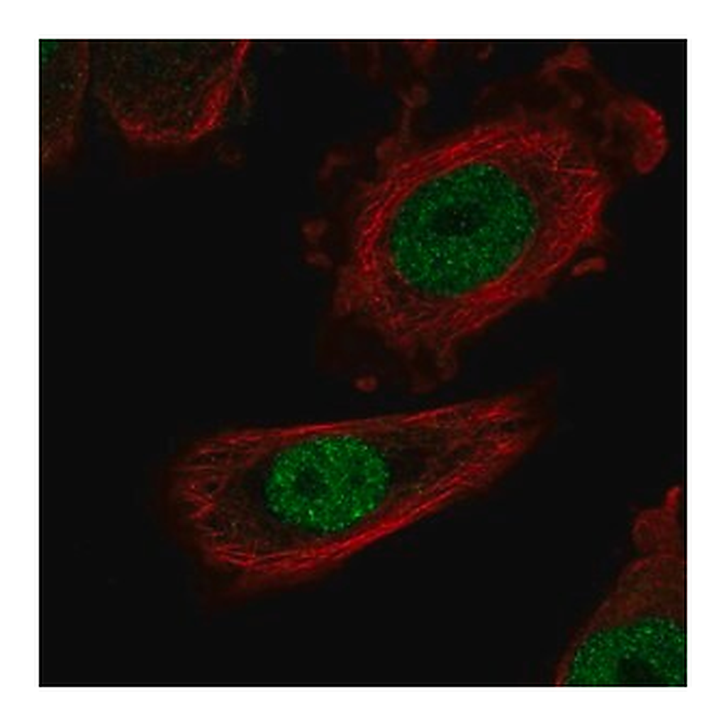 Merck Anti-ZHX1 antibody produced in rabbit