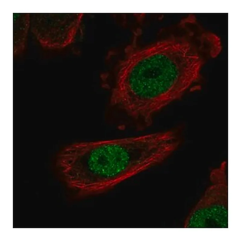 Merck Anti-ZHX1 antibody produced in rabbit