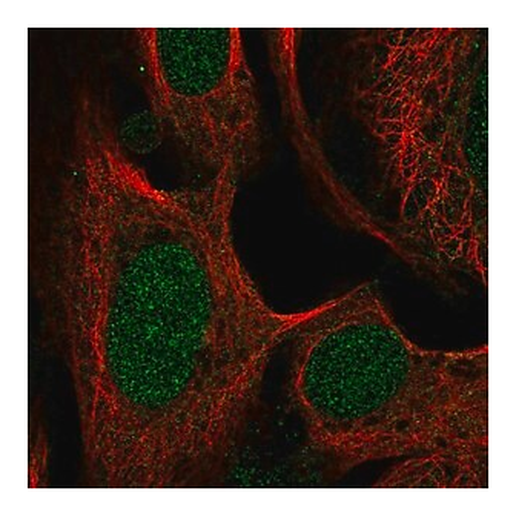 Merck Anti-SWI5 antibody produced in rabbit