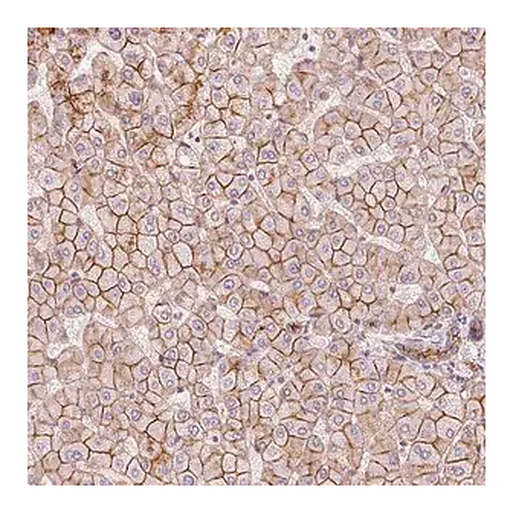 Merck Anti-SLC17A4 antibody produced in rabbit