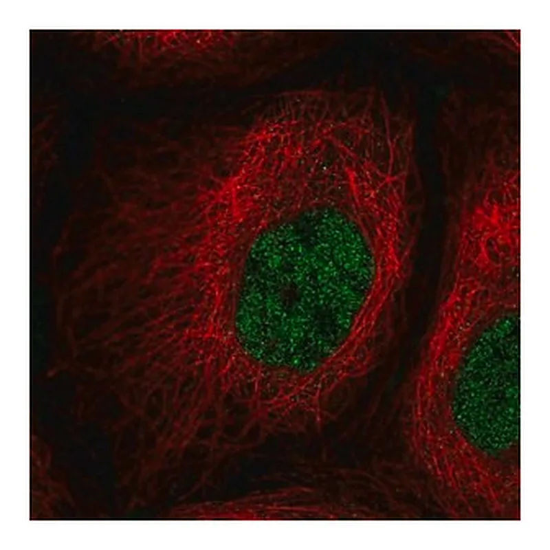 Merck Anti-PPIL2 antibody produced in rabbit