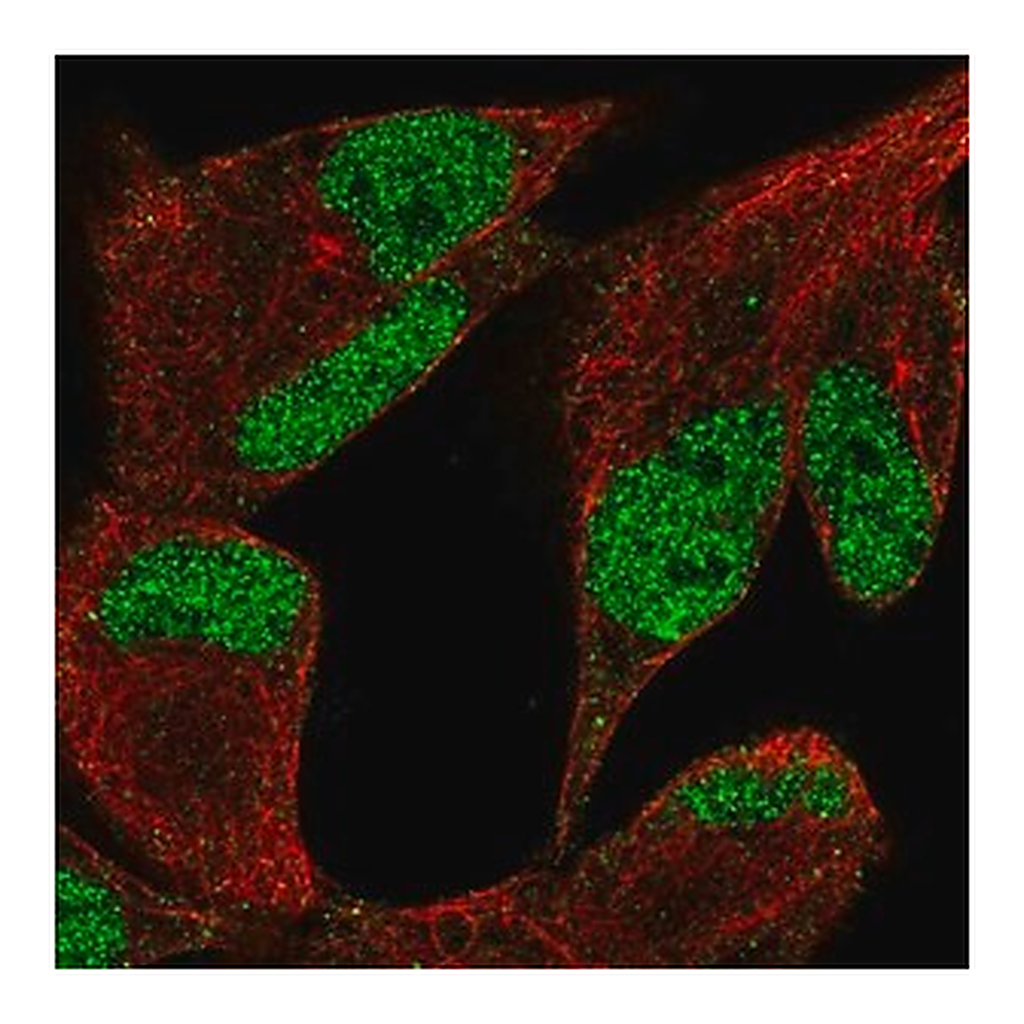 Merck Anti-KDM3A antibody produced in rabbit