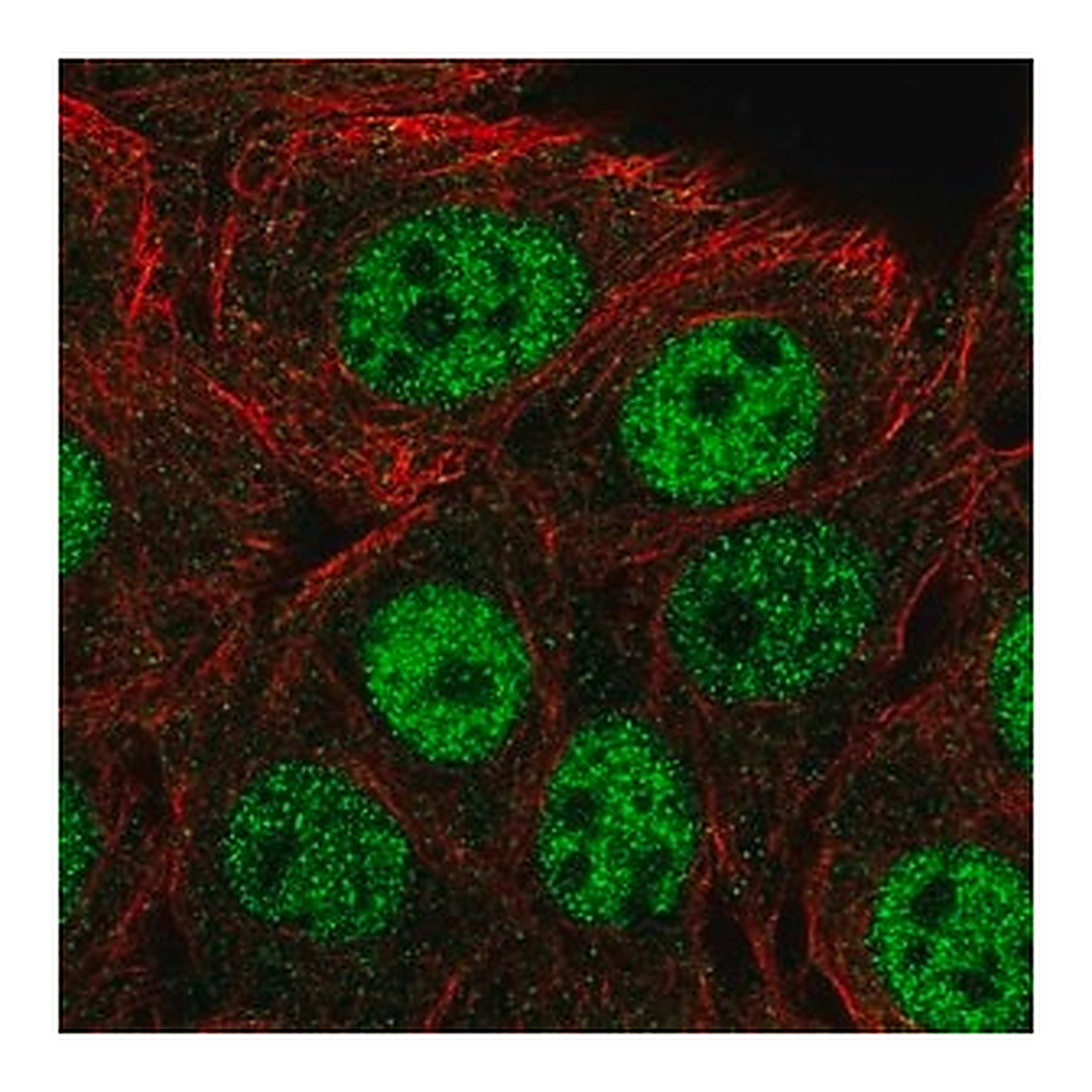 Merck Anti-CPSF1 antibody produced in rabbit