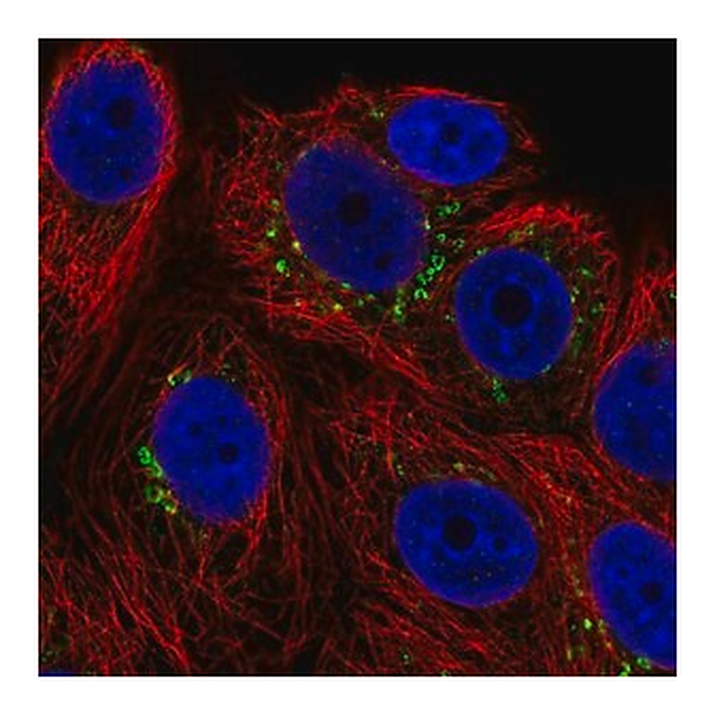 Merck Anti-POMT1 antibody produced in rabbit