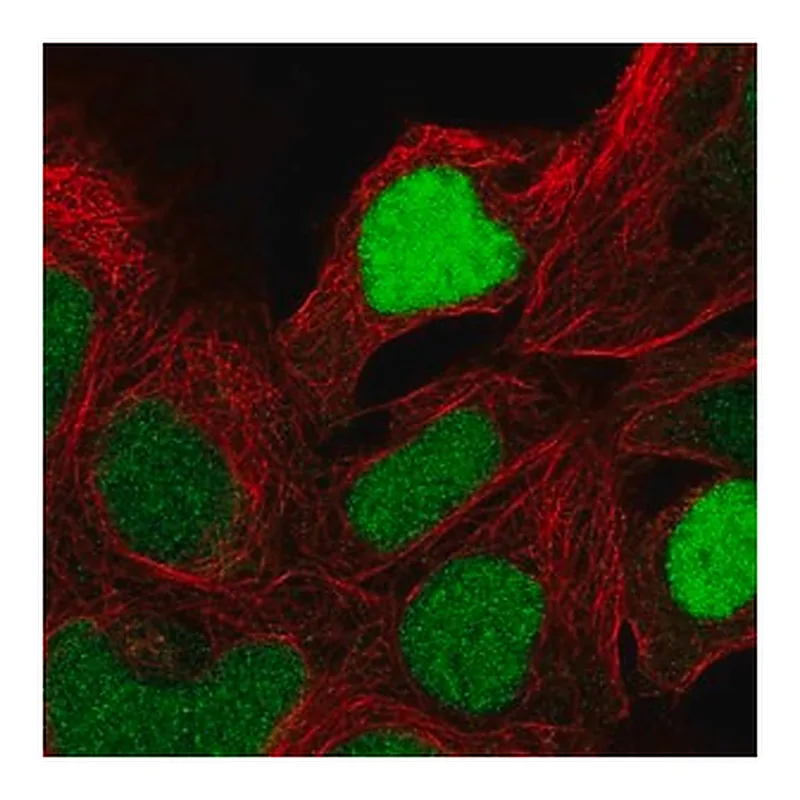 Merck Anti-ZNF444 antibody produced in rabbit