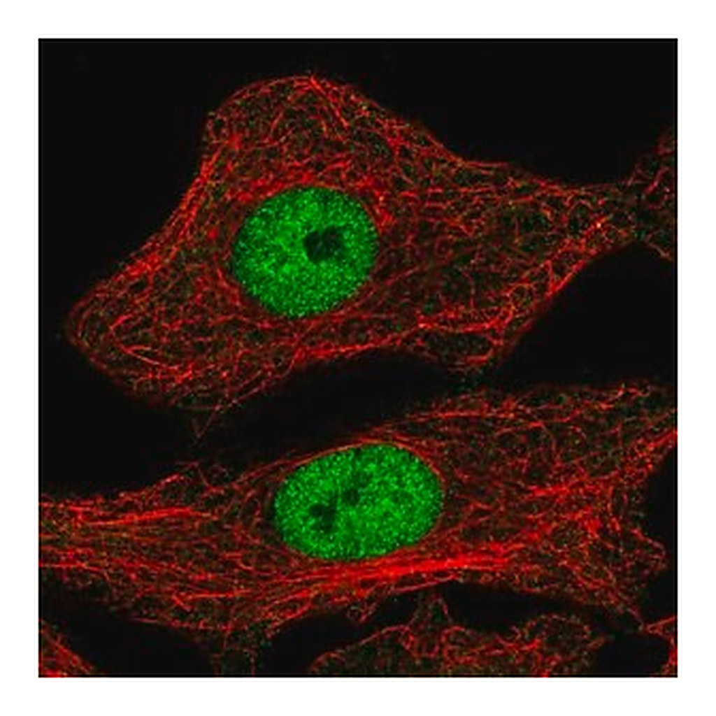 Merck Anti-MYPOP antibody produced in rabbit