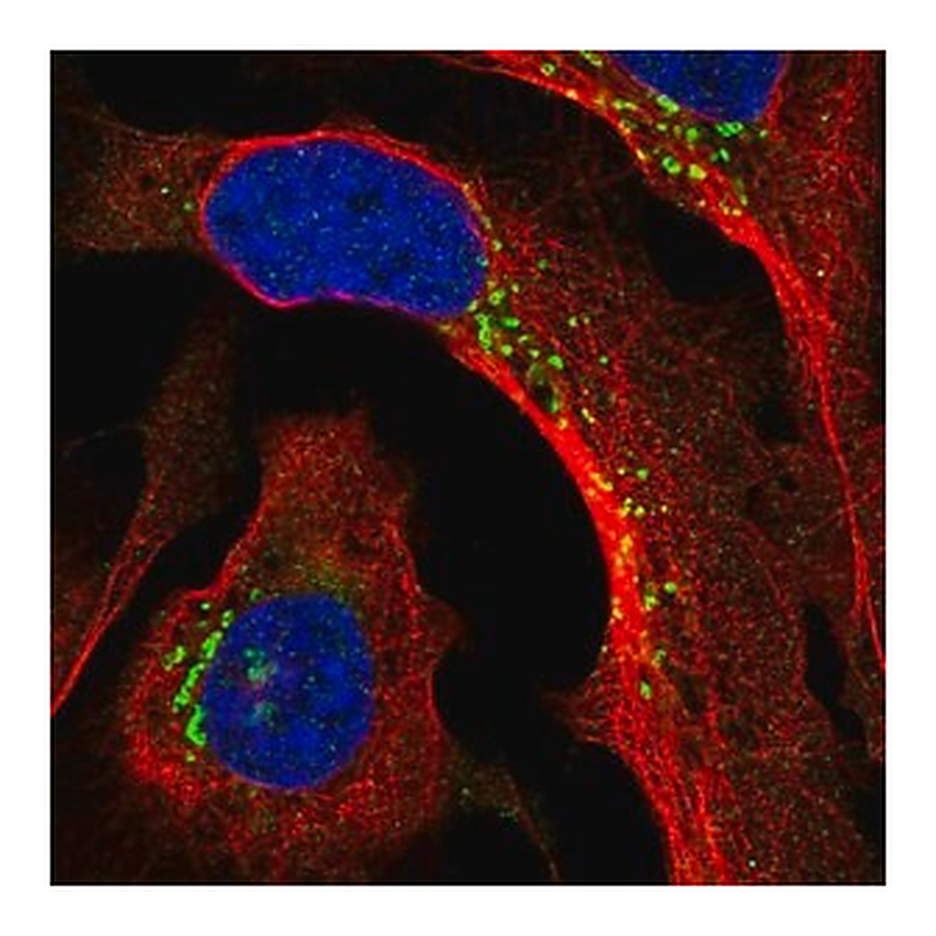 Merck Anti-PPP2R3A antibody produced in rabbit