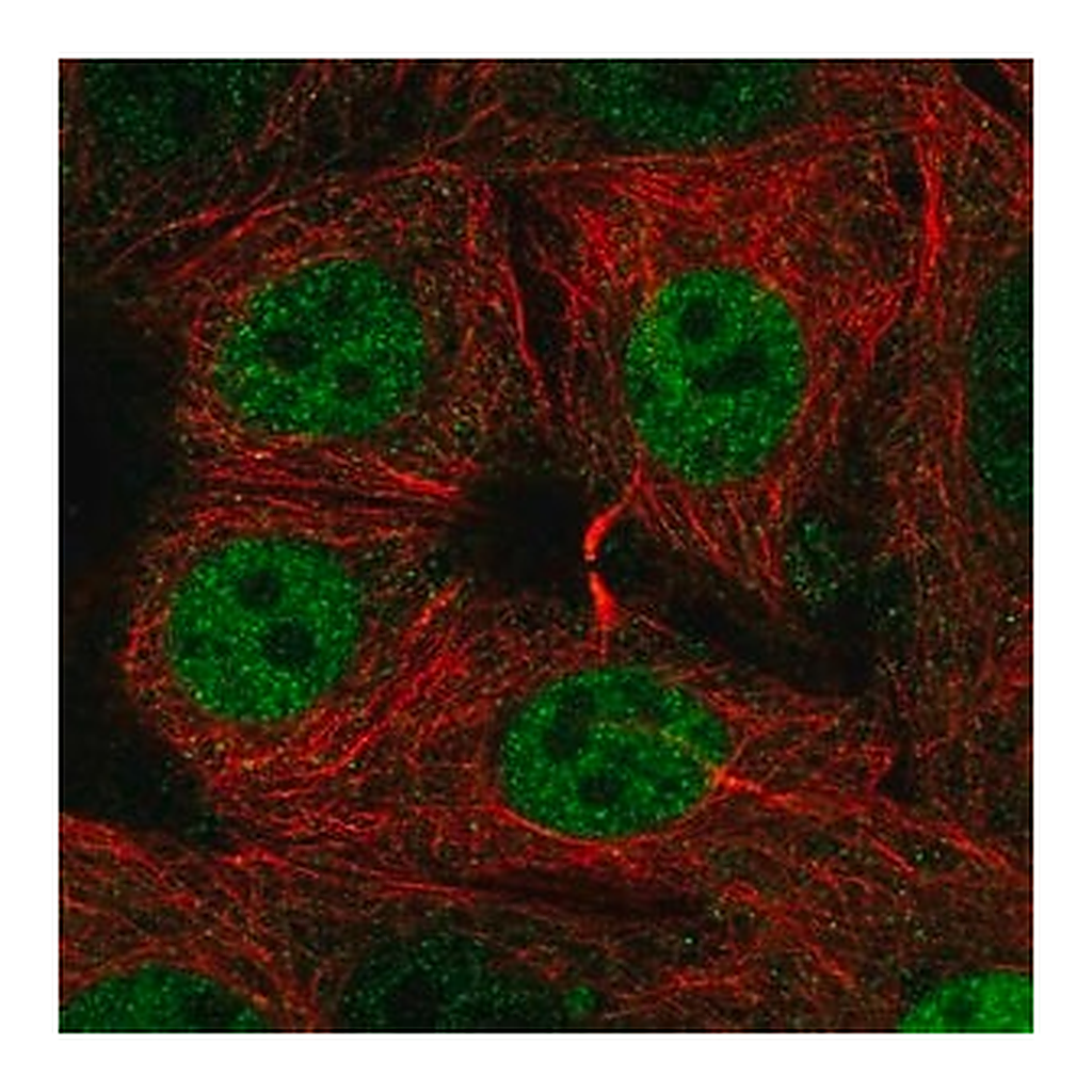 Merck Anti-SIVA1 antibody produced in rabbit