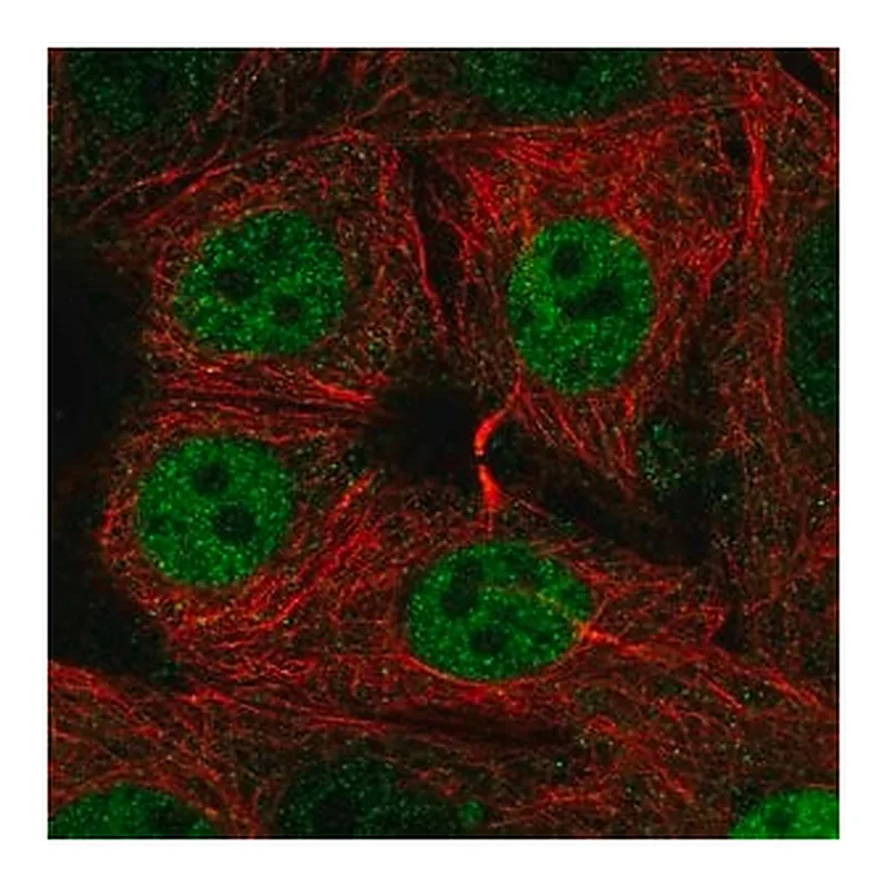 Merck Anti-SIVA1 antibody produced in rabbit
