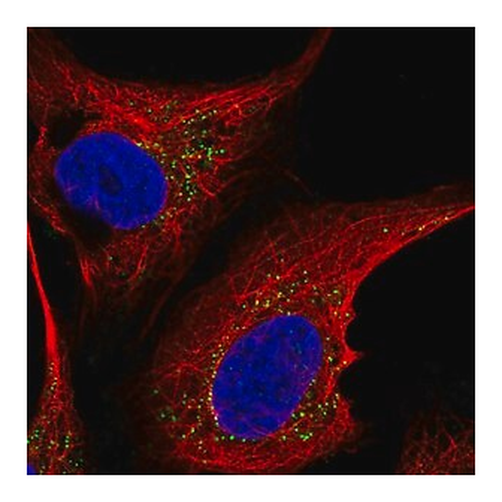 Merck Anti-ST6GALNAC5 antibody produced in rabbit