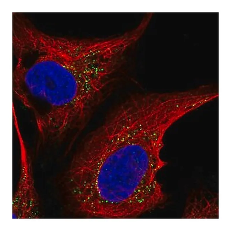Merck Anti-ST6GALNAC5 antibody produced in rabbit